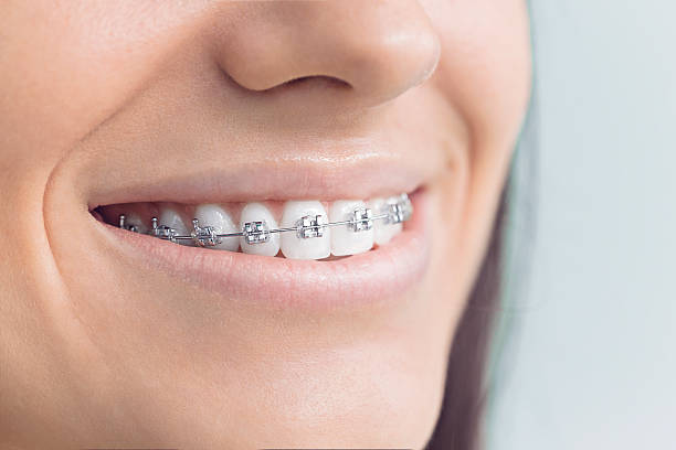 Best Sedation Dentistry  in Carey, OH